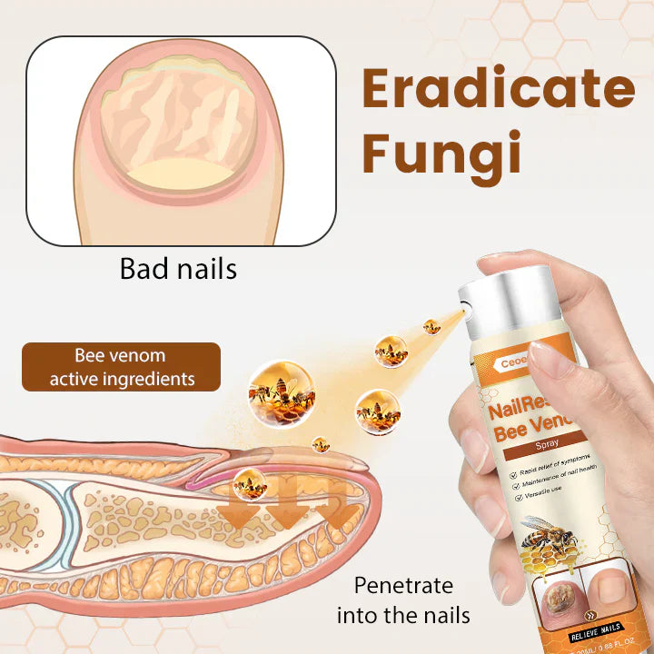 [CLEARANCE SALE] Crucial® NailRescue Bee Venom Spray | Rs. 999/- & Rs. 150/- Delivery Charges