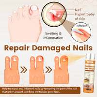 Thumbnail for [CLEARANCE SALE] Crucial® NailRescue Bee Venom Spray | Rs. 999/- & Rs. 150/- Delivery Charges