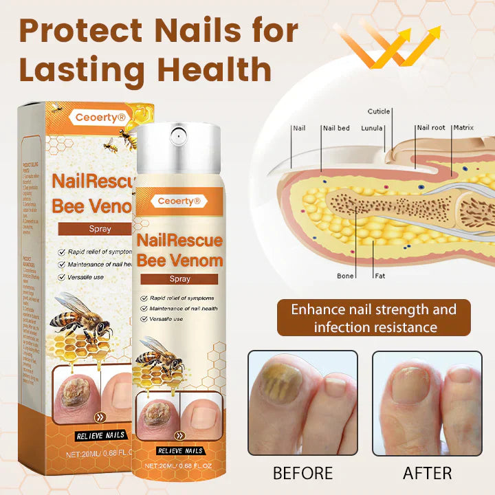[CLEARANCE SALE] Crucial® NailRescue Bee Venom Spray | Rs. 999/- & Rs. 150/- Delivery Charges