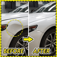 Thumbnail for Crucial™ Premium Car Dent Removal Kit